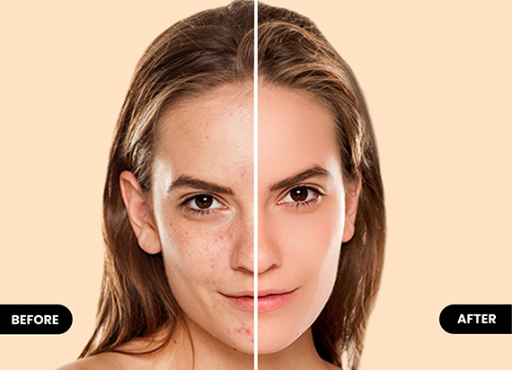 Face Editor
